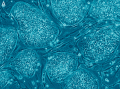 Lidské embryonální kmenové buňky, foto: Human embryonic stem cells.png, CC BY 2.5, cs.wikipedia.org