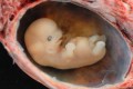 Human Embryo, lunar caustic, CC BY 2.0, commons.wikimedia